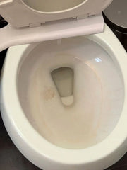Toilet Bowl Cleaner Starter Set